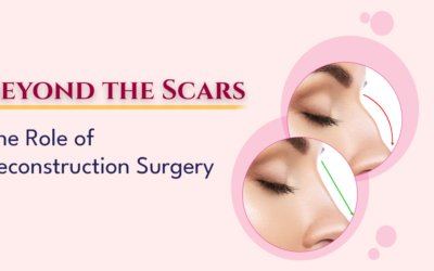 Beyond the Scars: The Transformative Role of Reconstructive Surgery