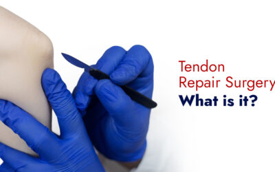 Tendon Repair Surgery: What is it?