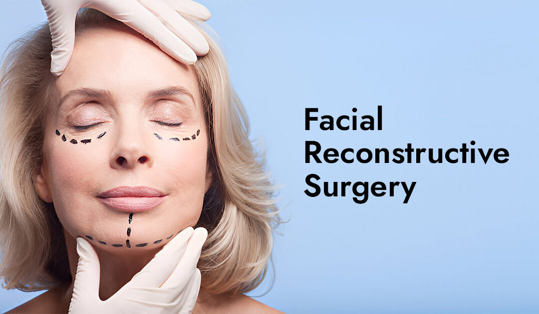 Facial Reconstructive Surgery