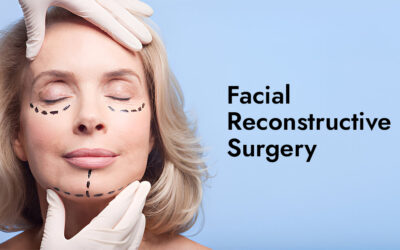 Facial Reconstructive Surgery