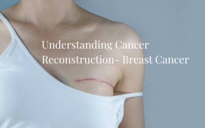 Understanding Cancer Reconstruction- Breast Cancer