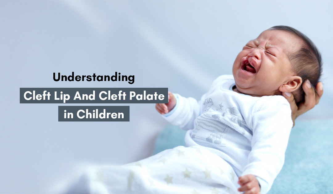 Cleft Lip