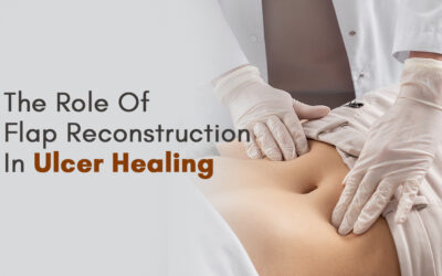 The Role Of Flap Reconstruction In Ulcer Healing
