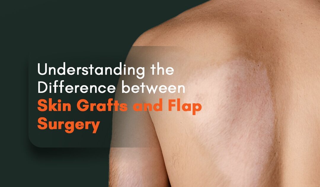 Skin Grafts and Flap Surgery