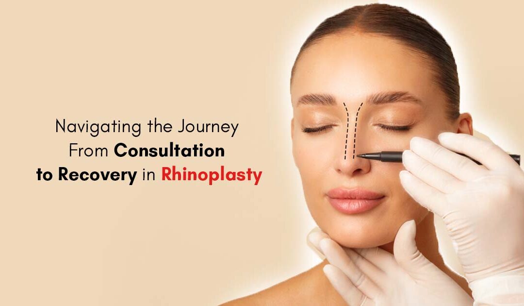 Rhinoplasty