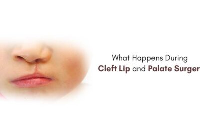 What Happens During Cleft Lip and Palate Surgery