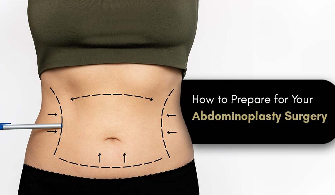 Abdominoplasty Surgery