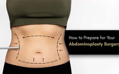 How to Prepare for Your Abdominoplasty Surgery