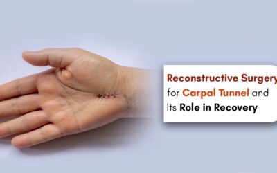 Reconstructive Surgery for Carpal Tunnel and Its Role in Recovery