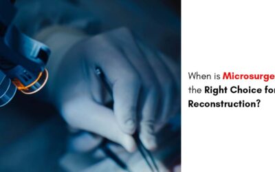 When is Microsurgery the Right Choice for Reconstruction?