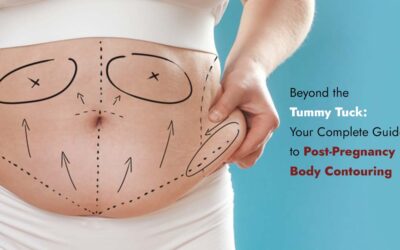 Beyond the Tummy Tuck: Your Complete Guide to Post-Pregnancy Body Contouring